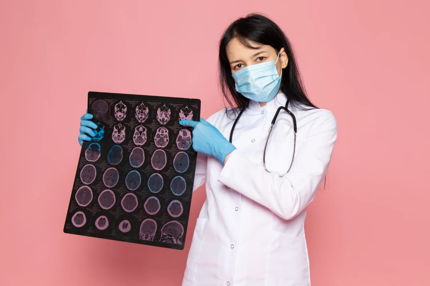 Adenomas hipofisarios en Guadalajara